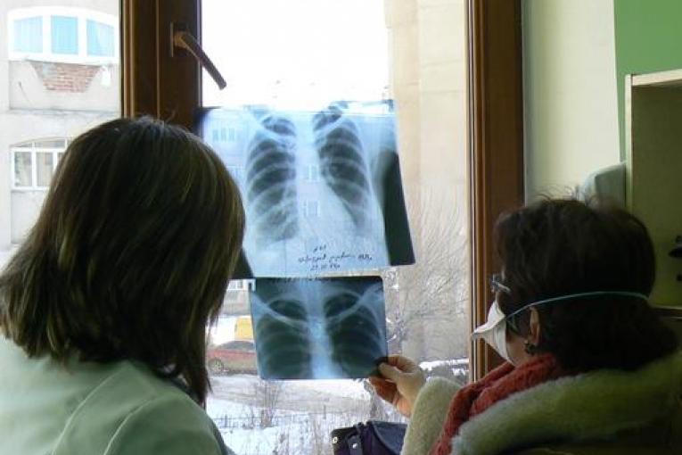 Prise en charge de la tuberculose résistante en Arménie. Andrea Bussotti/MSF