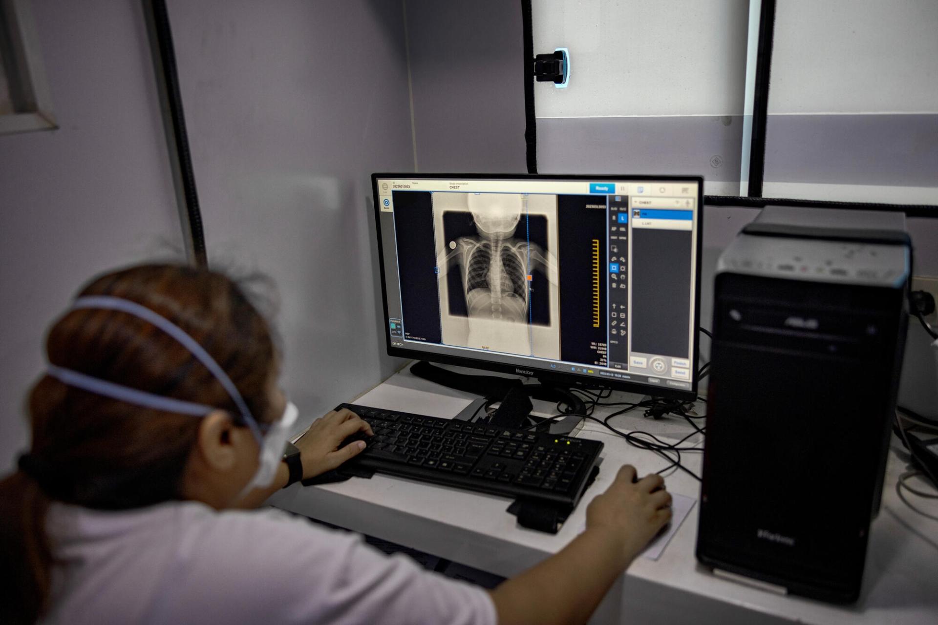Un membre des équipes MSF examine la radiographie d'un patient dans le cadre des opérations de recherche active de cas de tuberculose dans le quartier Tondo à Manille. Philippines. 13 mars 2023.