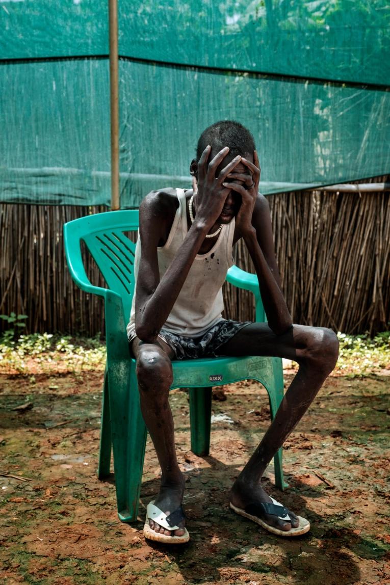 Gatchar, patient pris en charge pour une coïnfection au VIH et à la tuberculose au sein de l’hôpital de MSF du camp de protection des civils de Bentiu.
 © Peter Bauza