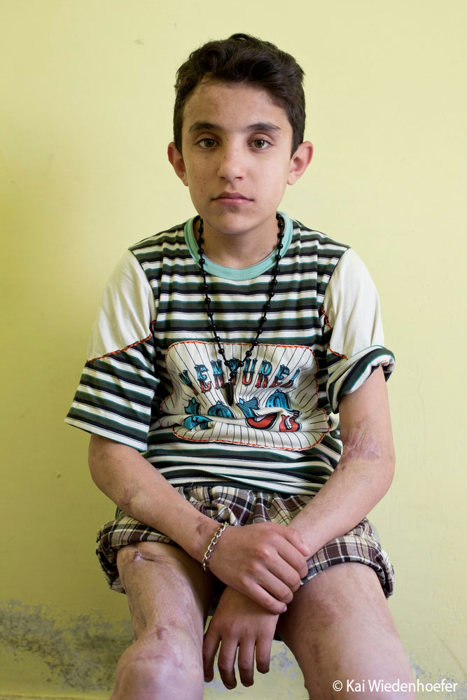 Sharif, réfugié de Syrie et patient de MSF à Amman en Jordanie