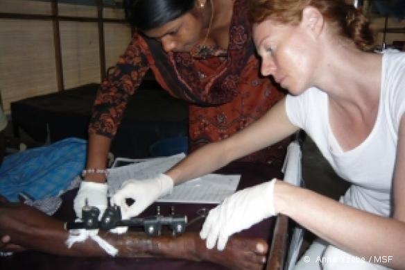 Sri Lanka. Des soins sont prodigués à un patient après la pose d'un fixateur externe