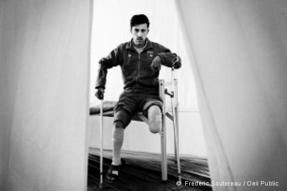 Riyad, 19 ans. Le 5 janvier, il a été grièvement blessé par un tir d'obus. Sa jambe gauche a dû être amputée. Il est désormais suivi à la clinique MSF de la ville de Gaza où il bénéficie de soins post-opératoires.
