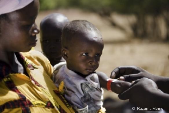 Dépistage de la malnutrition infantile. District de Yako (Burkina Faso). Mai 2009.