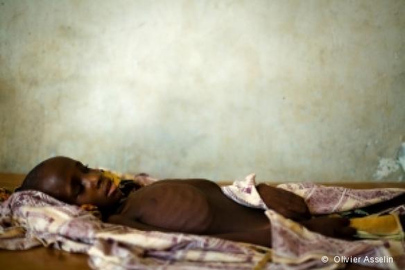 Bachirou Seyne, âgé de 7 ans, souffre de la méningite. Il est hospitalisé à Dosso, au Niger , le 21 avril 2009