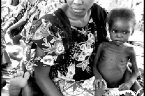 Un enfant soigné dans le centre nutritionnel, dans l'Etat de Yobe, Nigeria