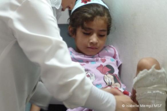 Clinique de soins post-opératoires de Gaza ville pansements sur petite fille brûlée