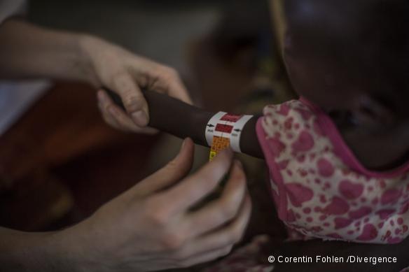 Dépistage de la malnutrition - Hôpital de Paoua - Janvier 2013