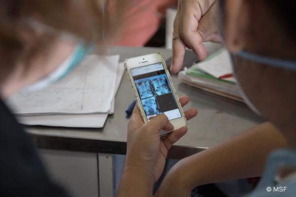 Un médecin MSF examine la radio des poumons d'un patient tuberculeux.