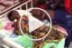 Niger : Palu et malnutrition, la double peine