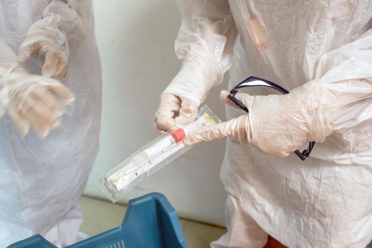 Le test virologique Polymerase Chain Reaction (PCR) sert au dépistage de la Covid-19. Ses résultats sont obtenus sous 48 heures.