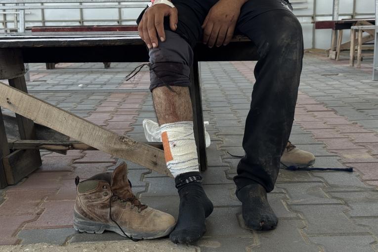 Un patient âgé de 32 ans, blessé par balle alors qu'il allait chercher de la nourriture pour sa famille dans un centre de distribution de la "Gaza Humanitarian Foundation", organisation orchestrée par Israël et les États-Unis. Il a été pris en charge par les équipes de MSF. Gaza, juin 2025