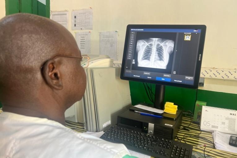 République centrafricaine : l’IA au service du dépistage de la tuberculose  