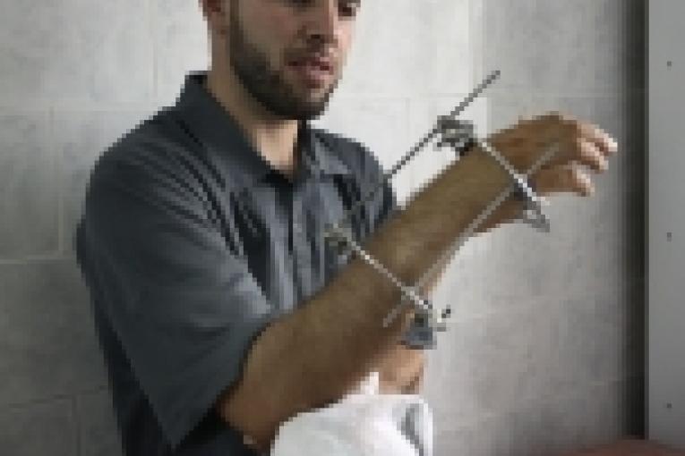 Patient opéré dans le cadre du programme de chirurgie reconstructive de l'hôpital N°9 de Grozny  Juillet 2006