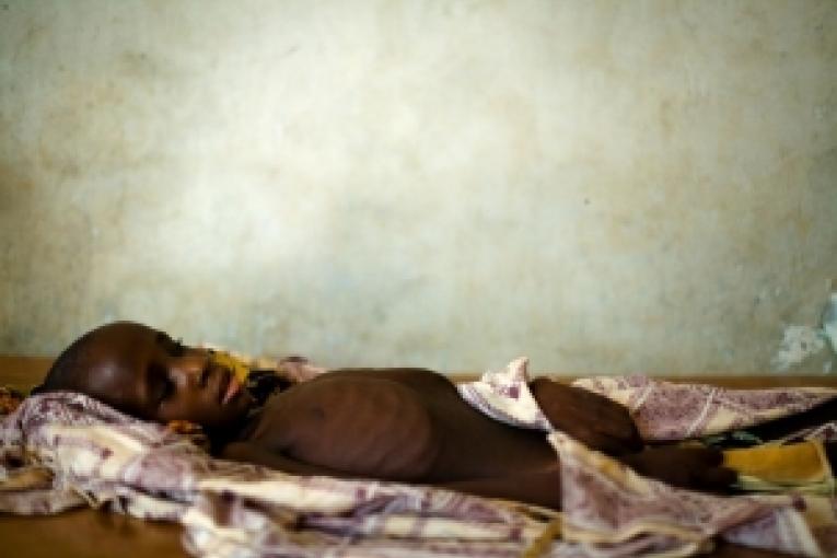 Bachirou Seyne âgé de 7 ans souffre de la méningite. Il est hospitalisé à Dosso au Niger le 21 avril 2009