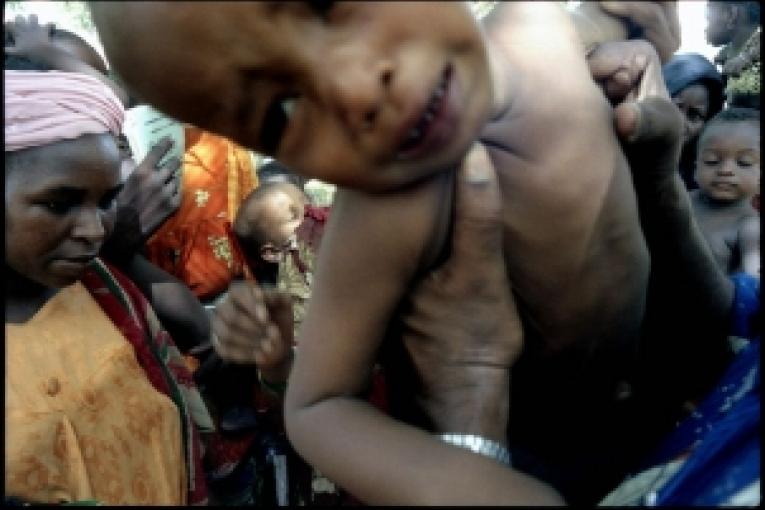Au coeur de la saison des pluies les effets renforcés du paludisme
des diarrhées et du manque de nourriture font basculer de plus en plus
d'enfants dans la malnutrition sévère. Chaque semaine les équipes de
MSF accueillent un nombre croissant d'e