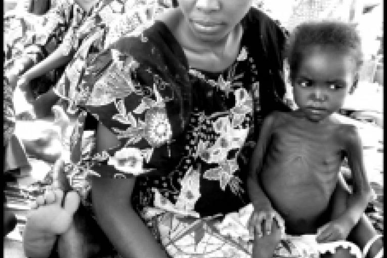 Un enfant soigné dans le centre nutritionnel dans l'Etat de Yobe Nigeria