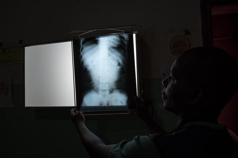 Un radiologiste de Médecins Sans Frontières examine un scanner à l'hôpital de Bangassou en République centrafricaine. 2017.