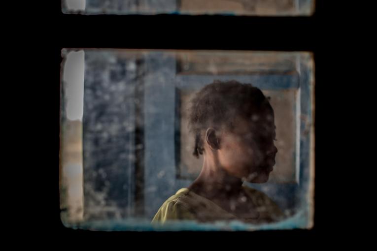 Une survivante de violences sexuelles, dans l'hôpital général de référence de Salamabila, où travaillent les équipes MSF. République démocratique du Congo. 