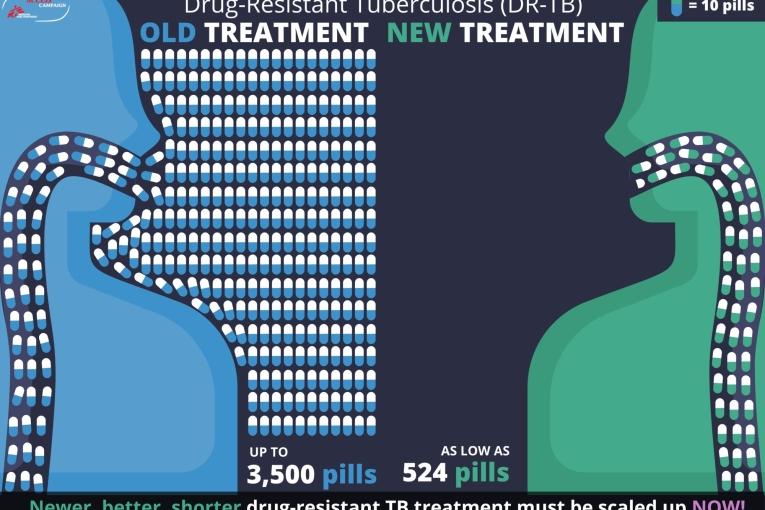 Tuberculose résistante : l’accès aux nouveaux traitements se heurte au manque d’accès au diagnostic 