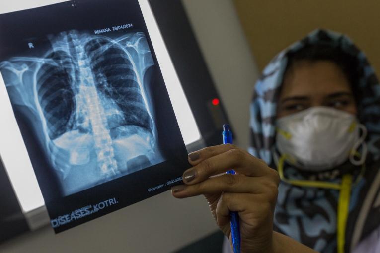 endTB-Q trial in Pakistan