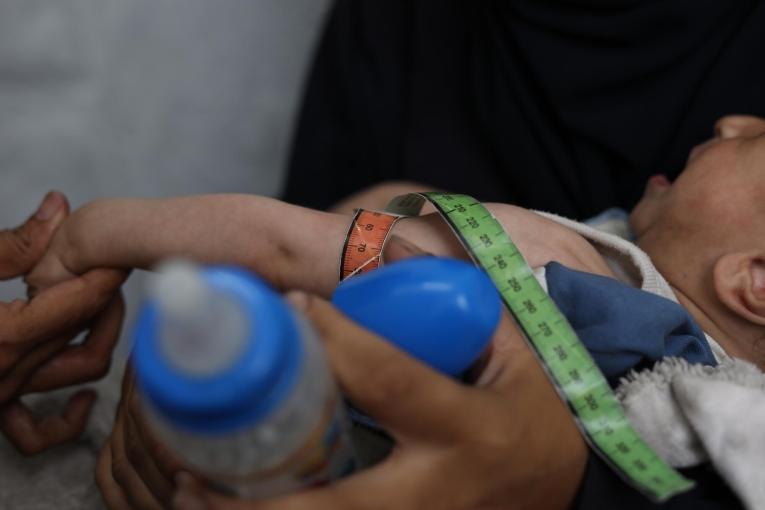 Malnutrition à Gaza