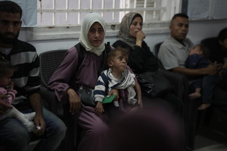 Starvation and Survival: Malnutrition in Gaza