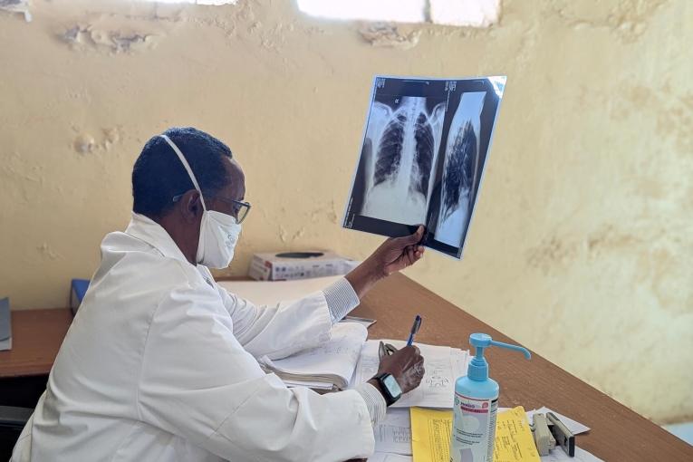 Le Dr Ahmed Hassan examine une radiographie lors d'une consultation à l'hôpital antituberculeux de Galkayo, dans la région de Mudug, en Somalie.