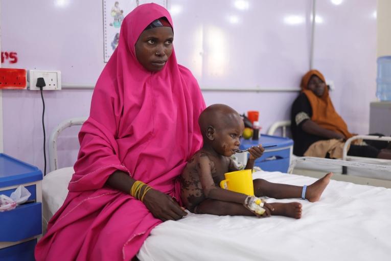 Une mère accompagne son enfant atteint de kwashiorkor dans l'unité de soins spécialisée de Katsina. L'enfant présente des gonflements et des lésions cutanées.