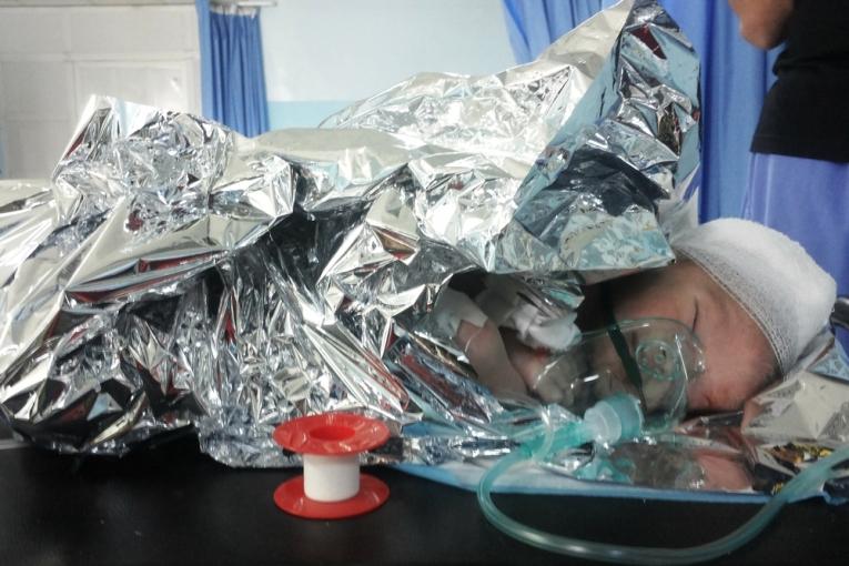 Majed un bébé de 27 jours blessé à la tête par un éclat provenant d’un baril d’explosifs. MSF