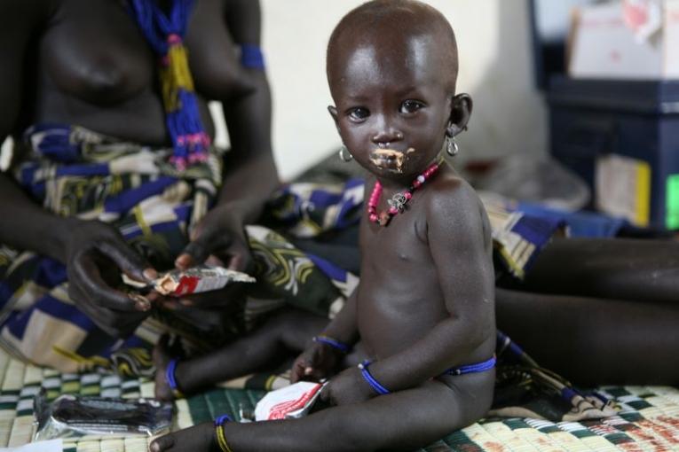 Une fillette souffrant de malnutrition est prise en charge dans le centre de santé de Pibor novembre 2007.