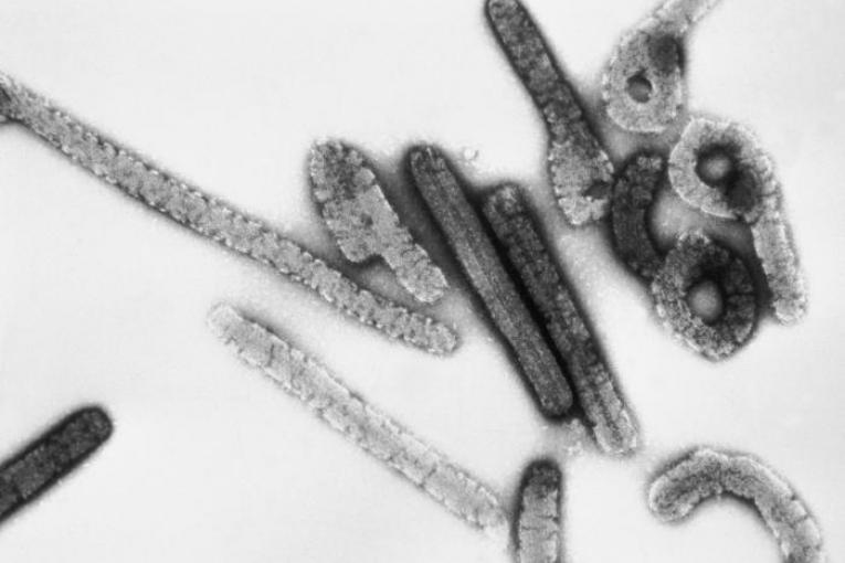 Particules virales Marburg vue par microscopie électronique.