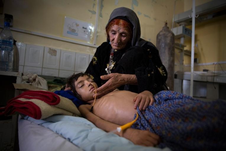 Malnutrition en Afghanistan