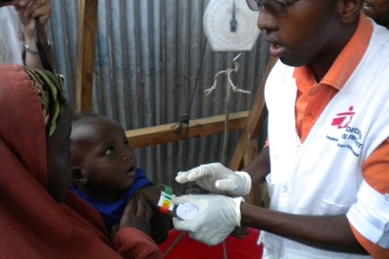 Centre nutritionnel MSF de Warshadaha à Mogadiscio. Dépistage de la malnutrition chez un enfant déplacé.