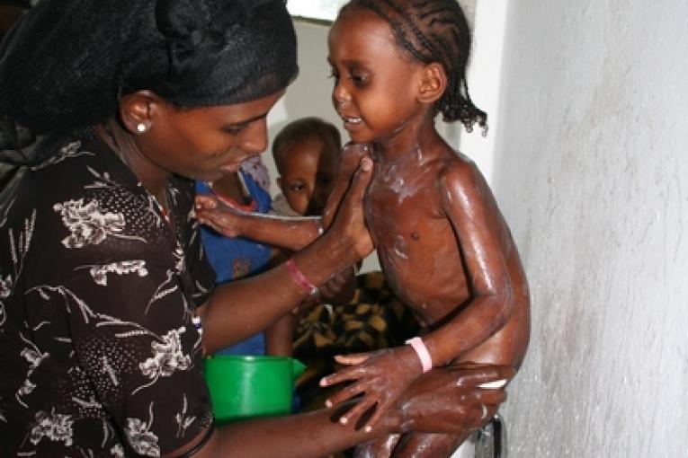 Sheleme centre de renutrition thérapeutique MSF sud de l'Ethiopie