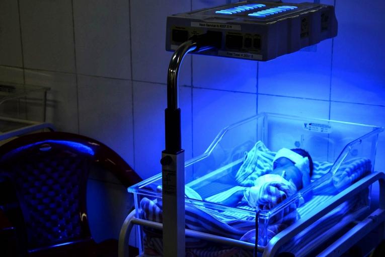 La jaunisse est une complication qui peut affecter les nouveau nés mais peut être traitée par l'exposition aux Ultraviolet (UV) sous une lampe de photothérapie.