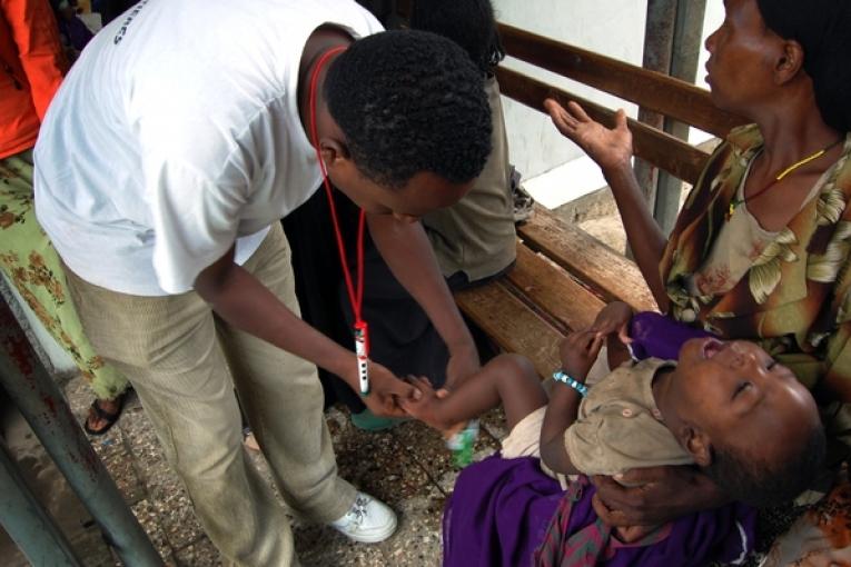 Un infirmier MSF regarde si l'enfant a des oedèmes aux pieds un signe de malnutrition sévère présent chez de nombreux patients actuellement soignés par MSF dans le sud de l'Ethiopie