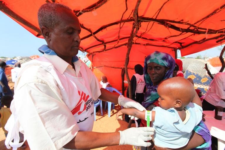 Mesure du périmètre bracchial d'un enfant manutri au Sud de Mogadiscio en Somalie.