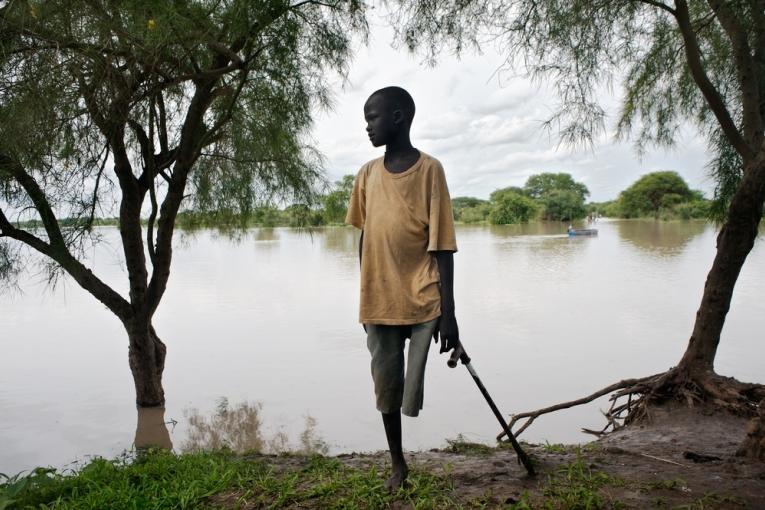 Un garçon dont la jambe a dû être amputée à la suite d'un manque d'accès au traitement après une morsure de serpent au Soudan du Sud en 2010. Cédric Gerbehaye