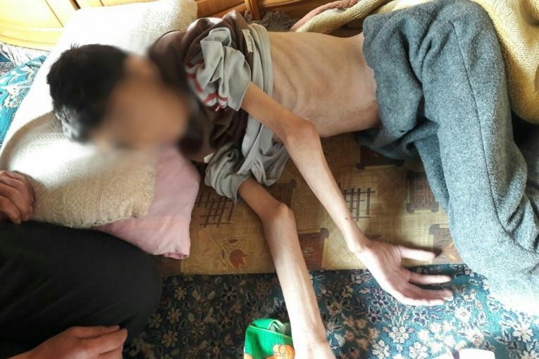 Mohammed 17 ans photographié le 2 avril 2016 à son domicile à Madaya. Il est décédé de malnutrition deux jours après. La photo ci dessus peut heurter les âmes sensibles. MSF se refuse habituellement à publier des images dégradantes ou dommageabl