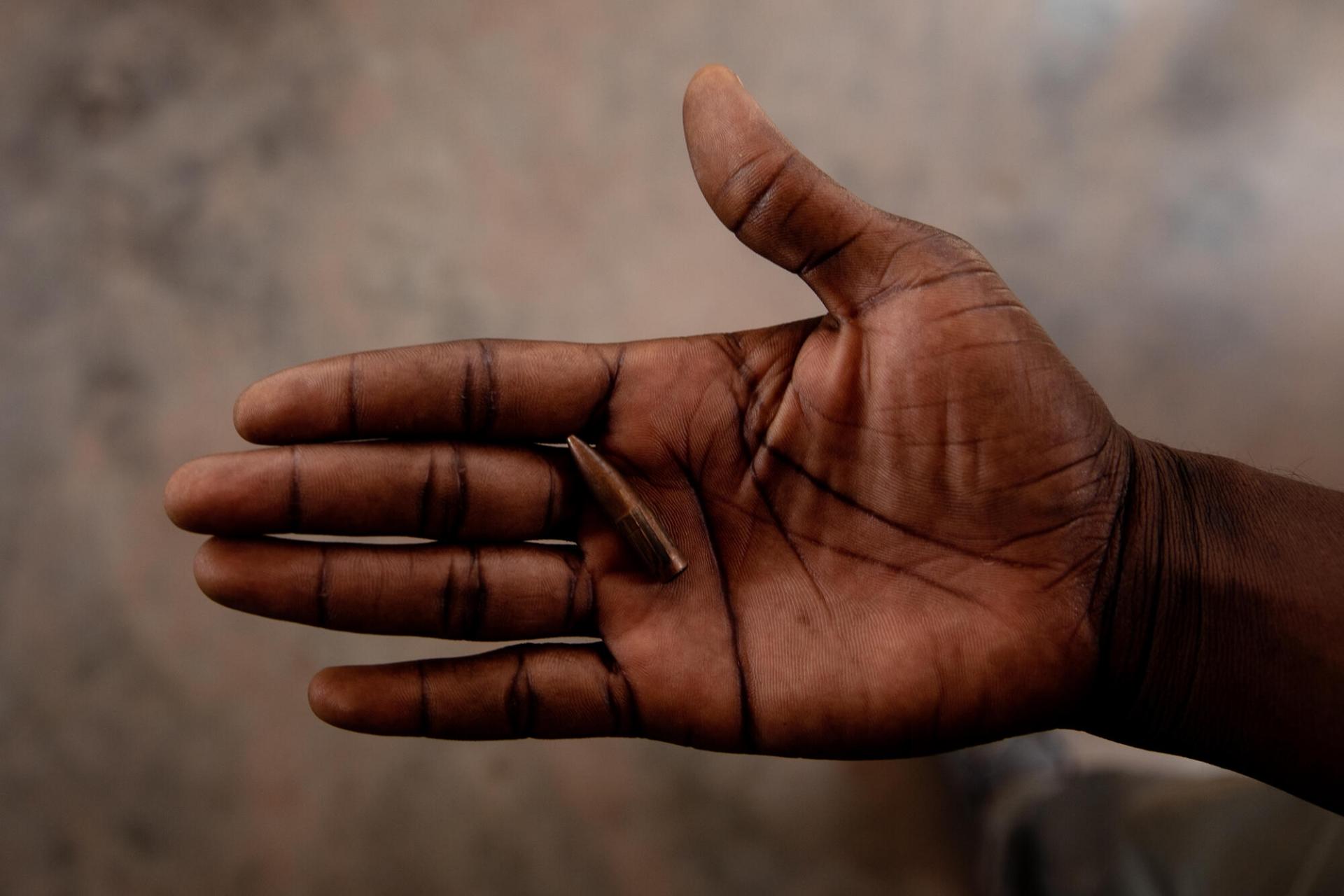 France Beldo, 31 ans, a été blessée à la main et à l’épaule lors des combats qui ont éclaté à Bangui, en amont de l’élection présidentielle en République centrafricaine en décembre 2020. De nombreuses balles perdues ont été retrouvées dans son jardin, comme celle-ci. 