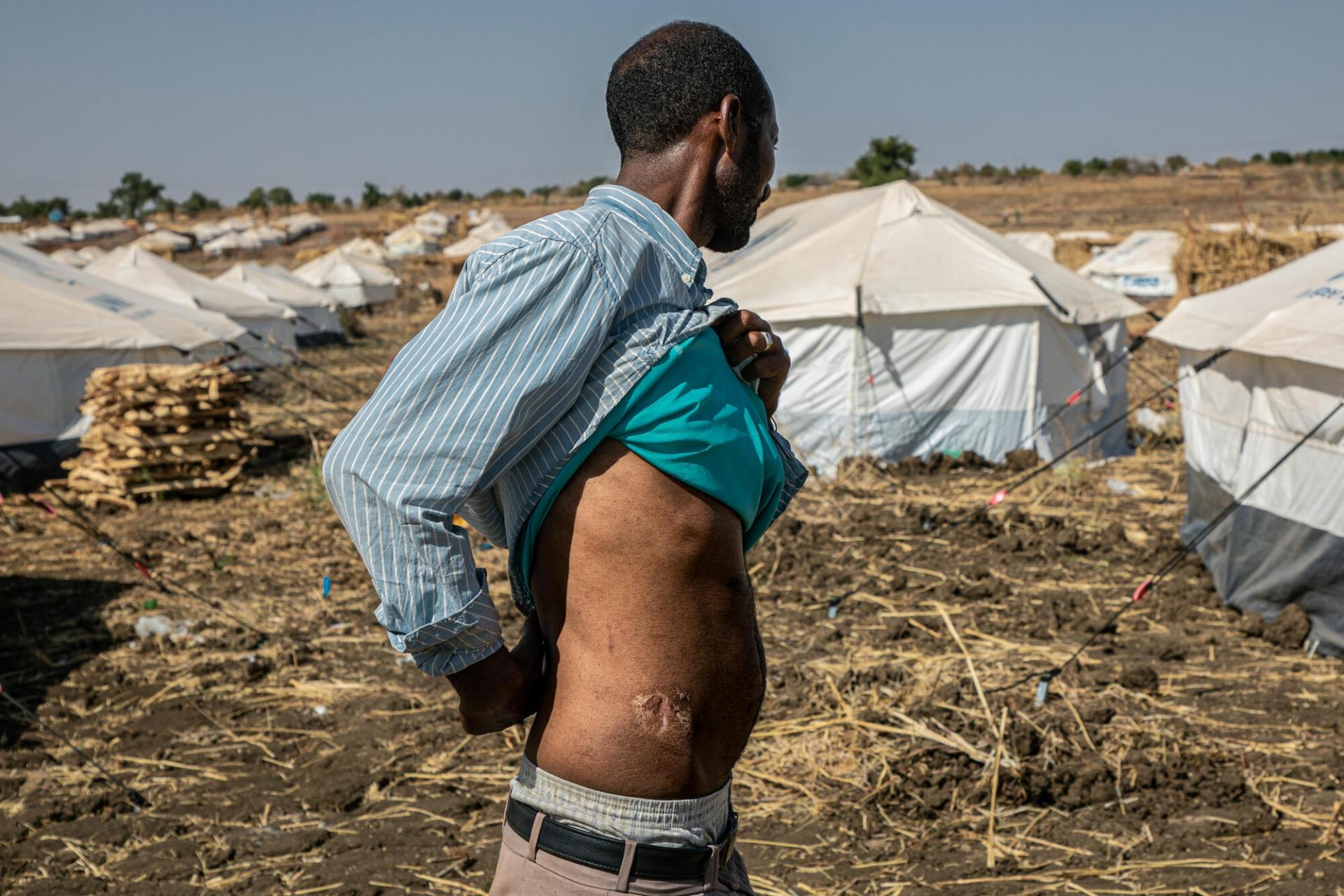 Portrait de Solomon, originaire d’Abderafi, un village à la frontière entre le Tigré et la région Amhara, en Éthiopie. L’homme de 34 ans a été détenu et blessé par une milice locale. Après avoir assisté au meurtre de deux de ses collègues, il s’est enfui pour rejoindre le Soudan voisin, et le camp d’Um Rakuba où MSF intervient. 