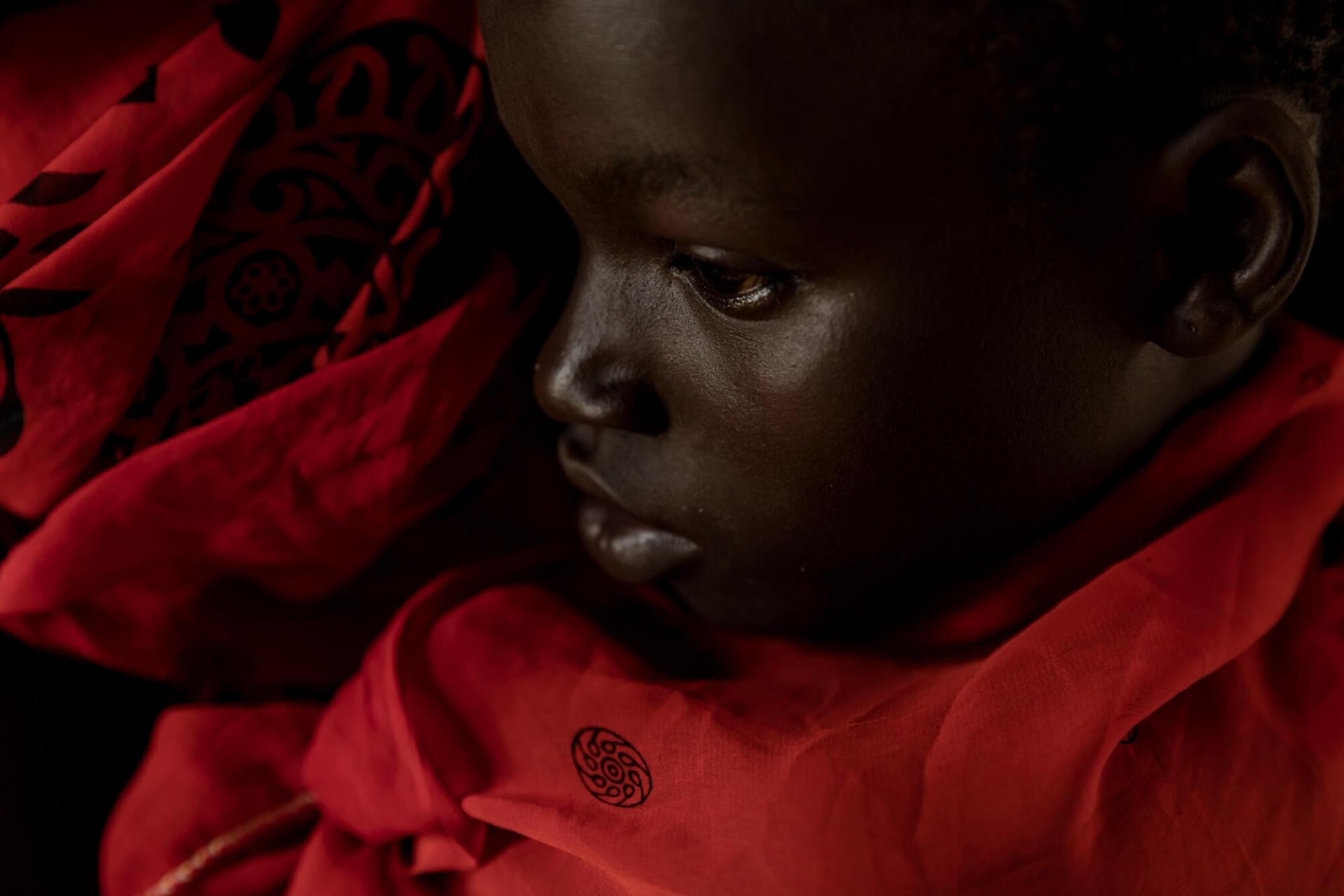 Portrait de la jeune Zara, atteinte de paludisme et prise en charge à l’hôpital d’Aweil, soutenu par MSF.