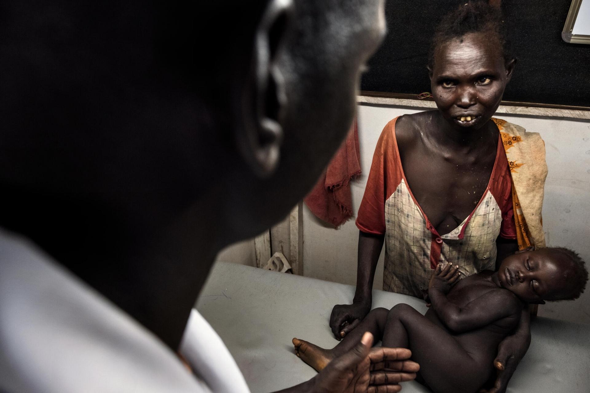 Une mère et son enfant, fiévreux et certainement touché par le paludisme et l’anémie à Aweil au Soudan du Sud