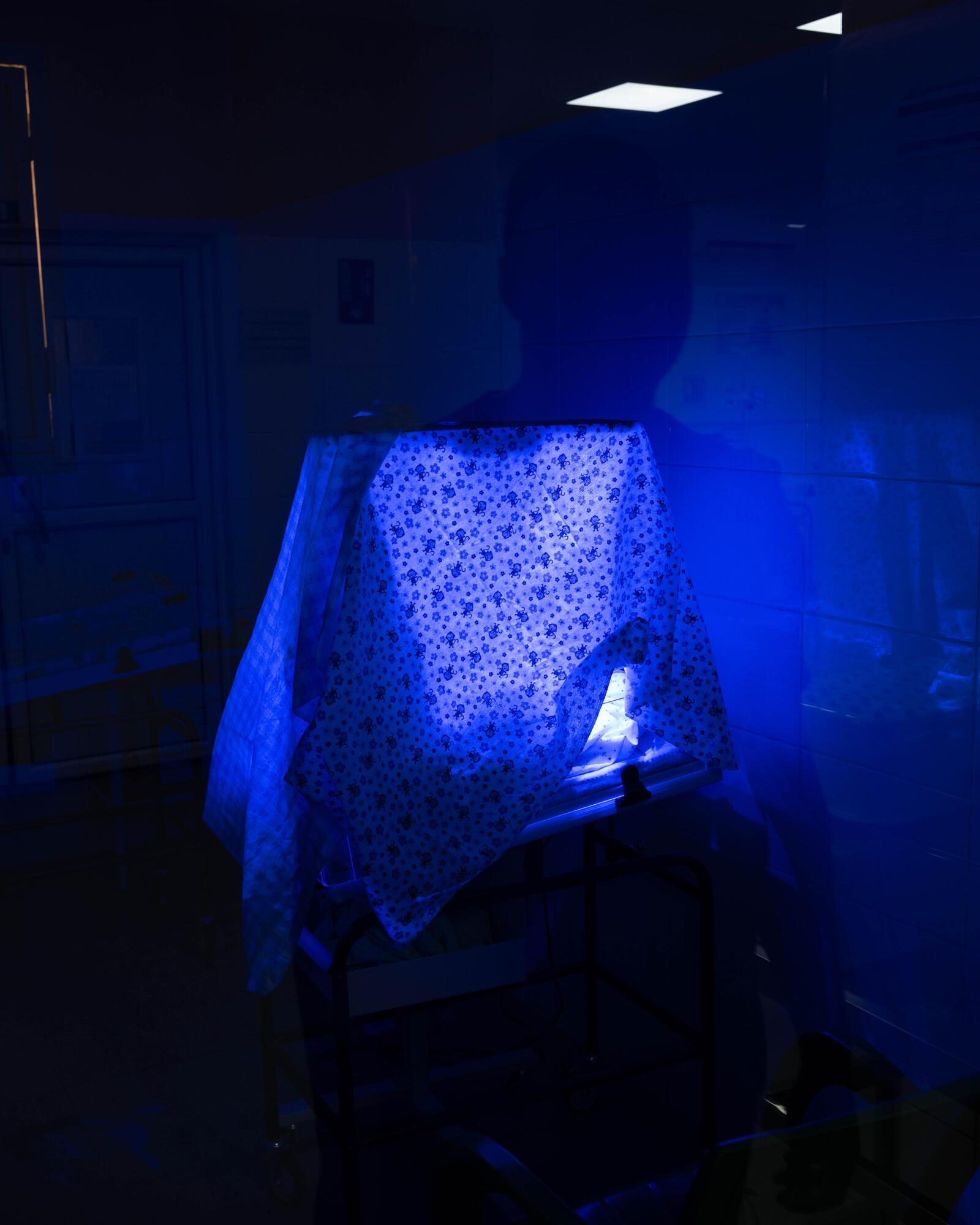 Vue d'un enfant placé sous lampe UV pour une courte période.