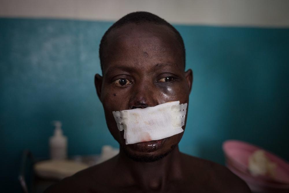 Léonard Gangbe, blessé et pris en charge par MSF.
 © Alexis Huguet