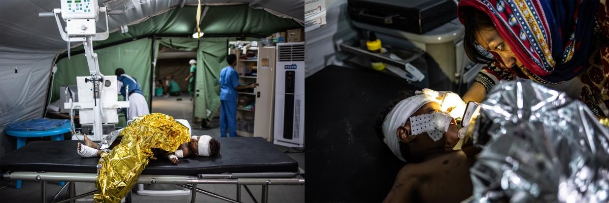 Un enfant blessé dans l’explosion d’une mine à Mawza, dans le gouvernorat de Taïz, est soigné aux urgences de l’hôpital MSF de Mocha. Trois autres membres de sa famille ont été blessés, deux sont arrivés morts à l’hôpital. L’enfant a des éclats dans la crâne, le bras et sur son visage. Il est transféré à Aden pour faire un IRM. Décembre 2018. Yémen.
 © Agnès Varraine-Leca