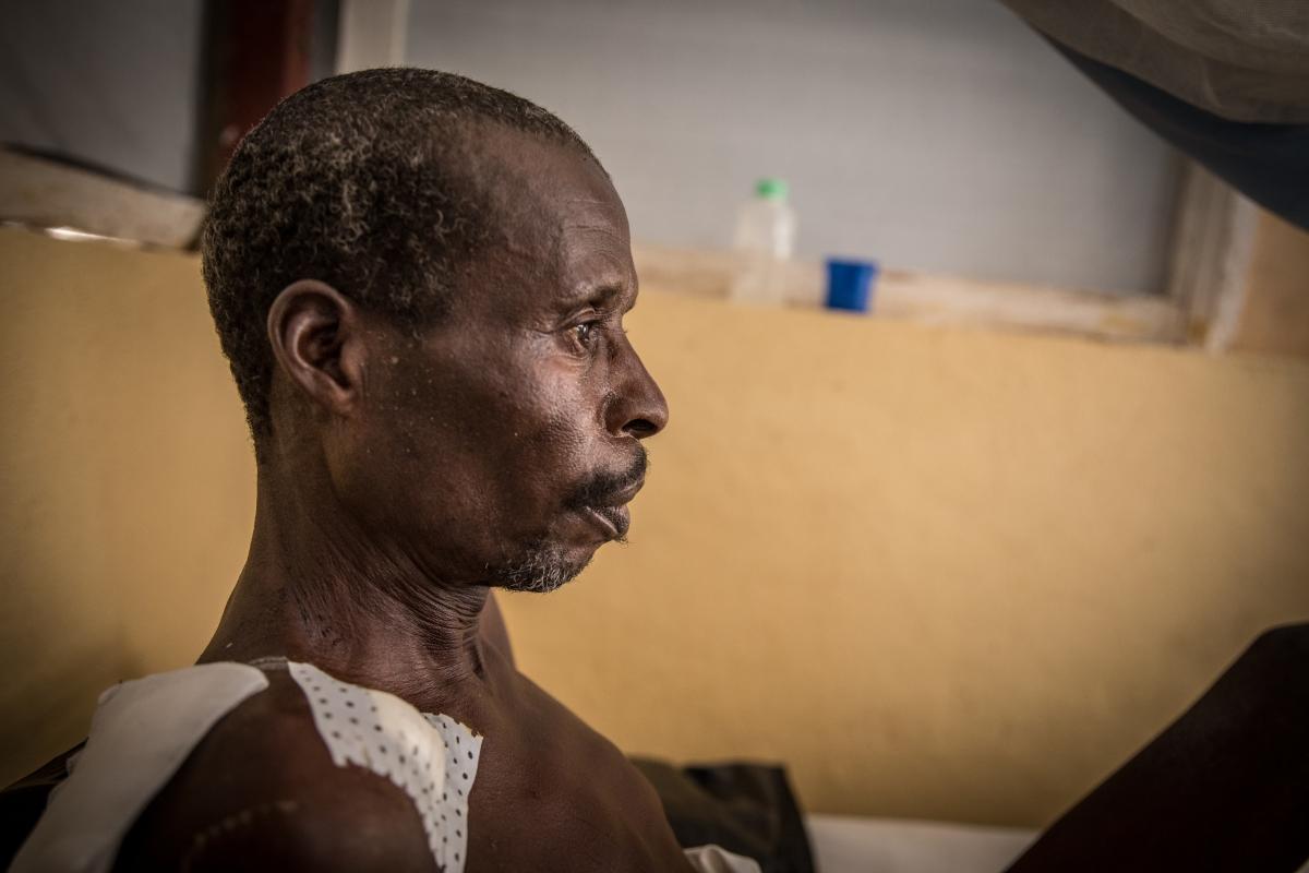 Josua, patient à l'Hôpital régional de Maroua : «&nbsp;J’ai été traité au bloc de chirurgie. Je me sens mieux maintenant qu’ils ont commencé à me traiter, ils me donnent des pilules contre la douleur&nbsp;».
 © Pierre-Yves Bernard / MSF