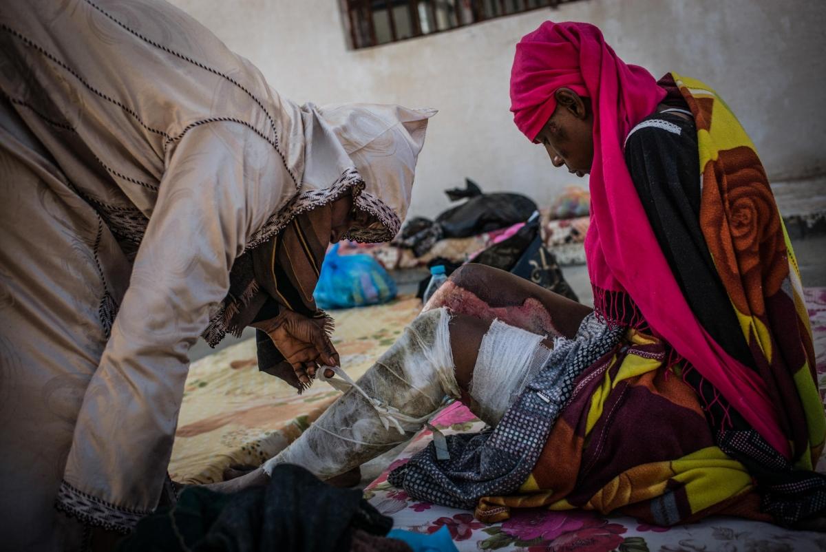 Une femme brûlée aux jambes reçoit de l'aide d'une autre détenue dans le camp de Sorman.
 © Guillaume Binet/Myop