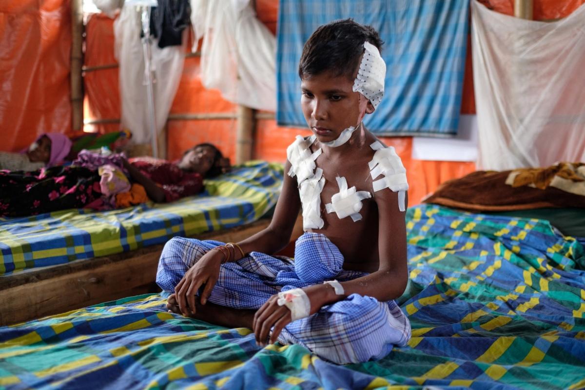 Un jeune garçon blessé est assis sur son lit dans la structure de santé de MSF, camp de réfugiés de Kutupalong
 © Antonio Faccilongo