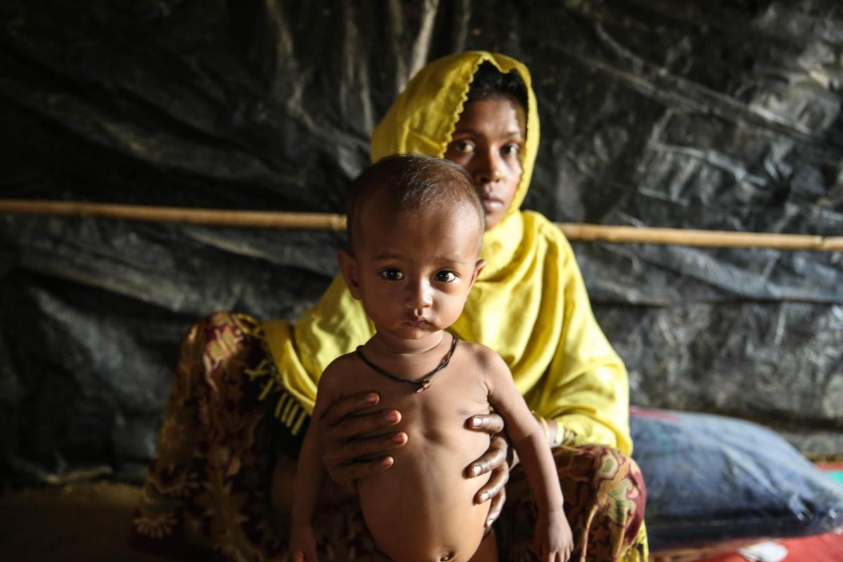 Al Maskata avec sa fille de 7 mois qui souffre de malnutrition.
 © Mohammad Ghannam/MSF